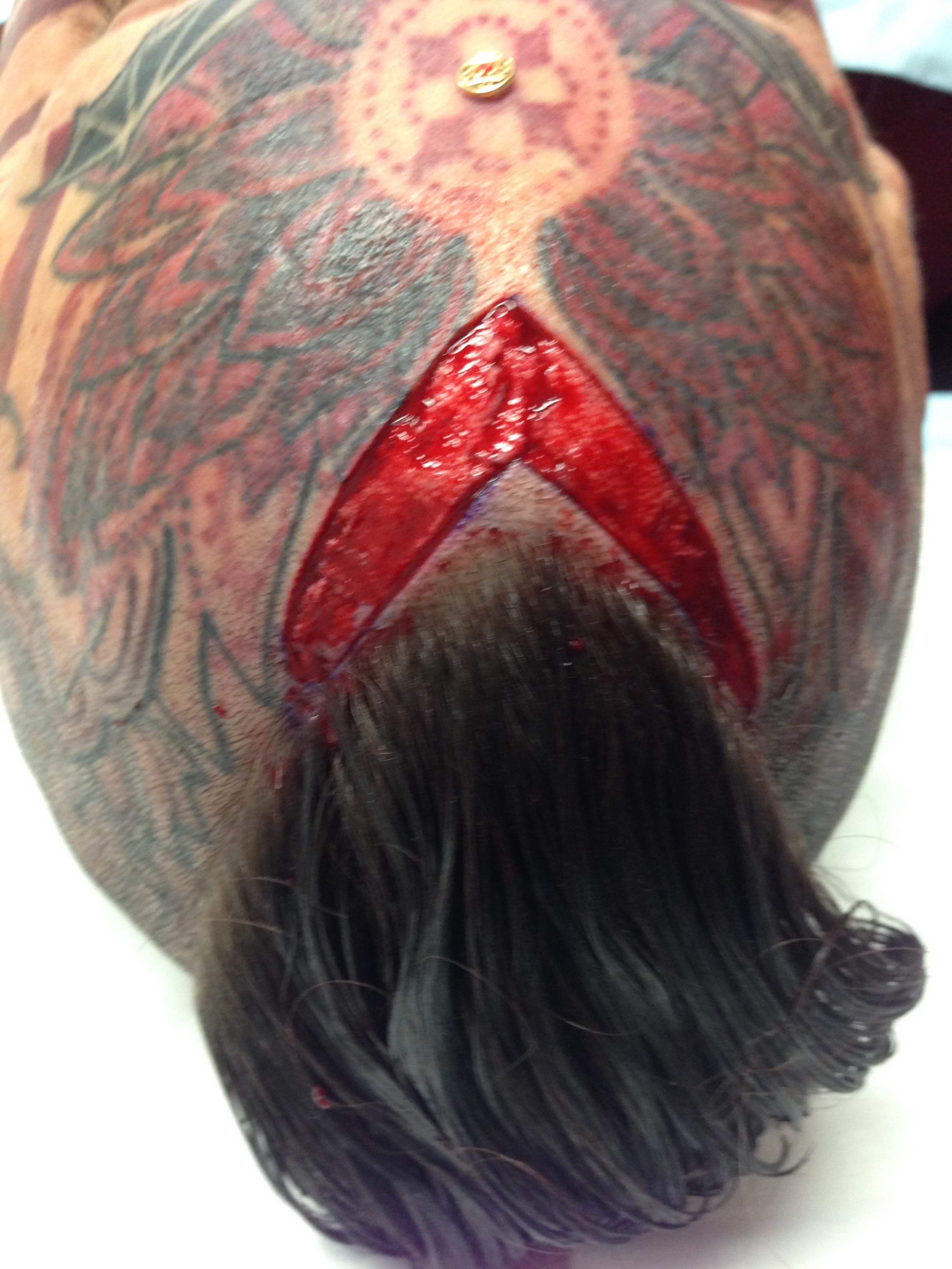  Scarification.&nbsp;&nbsp;(The 4th Wall, stories of tattoos &amp; body modification, by Fareed Kaviani: www.the4thwall.net) 