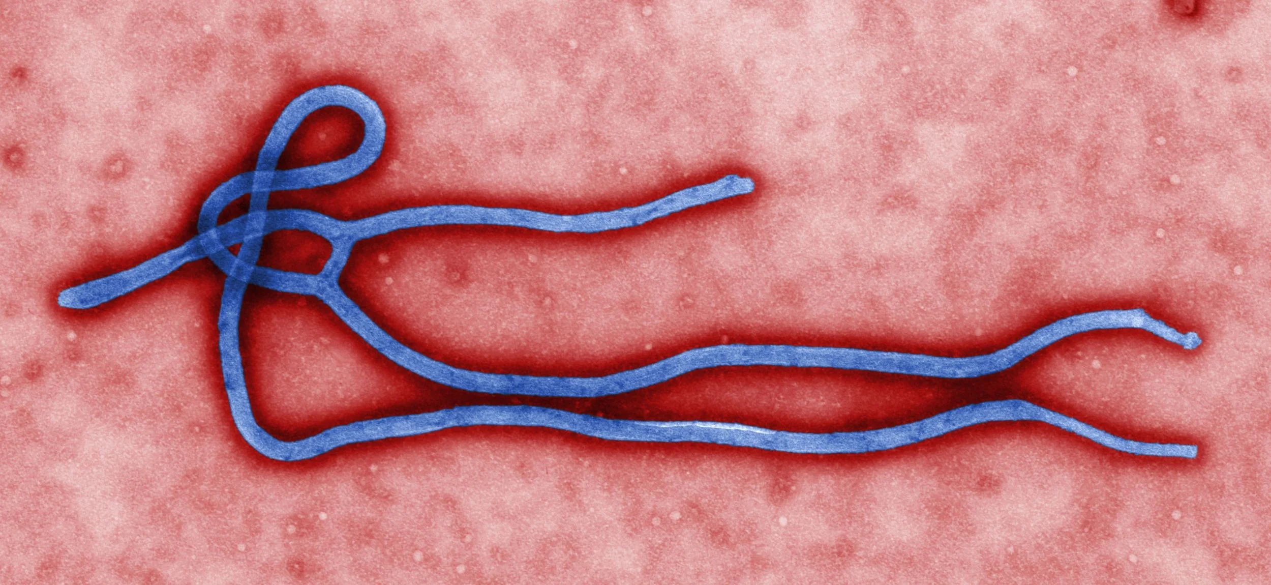 Ebola virus virion. Photo courtesy of Wikimedia Commons