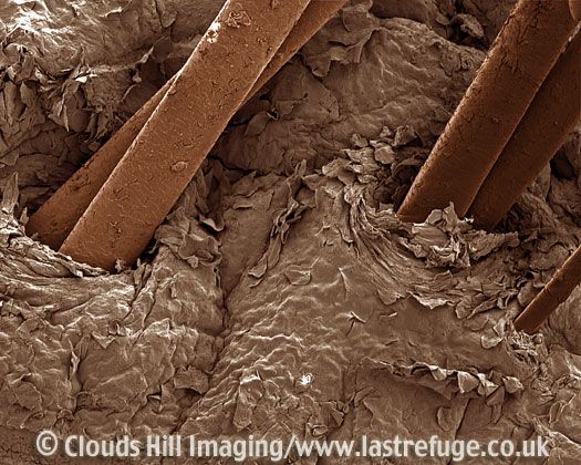 This is your hair growing out of your skin, note the space around the hair where your skin absorbs the oil