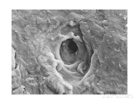 This is your skin magnified to a frightening level