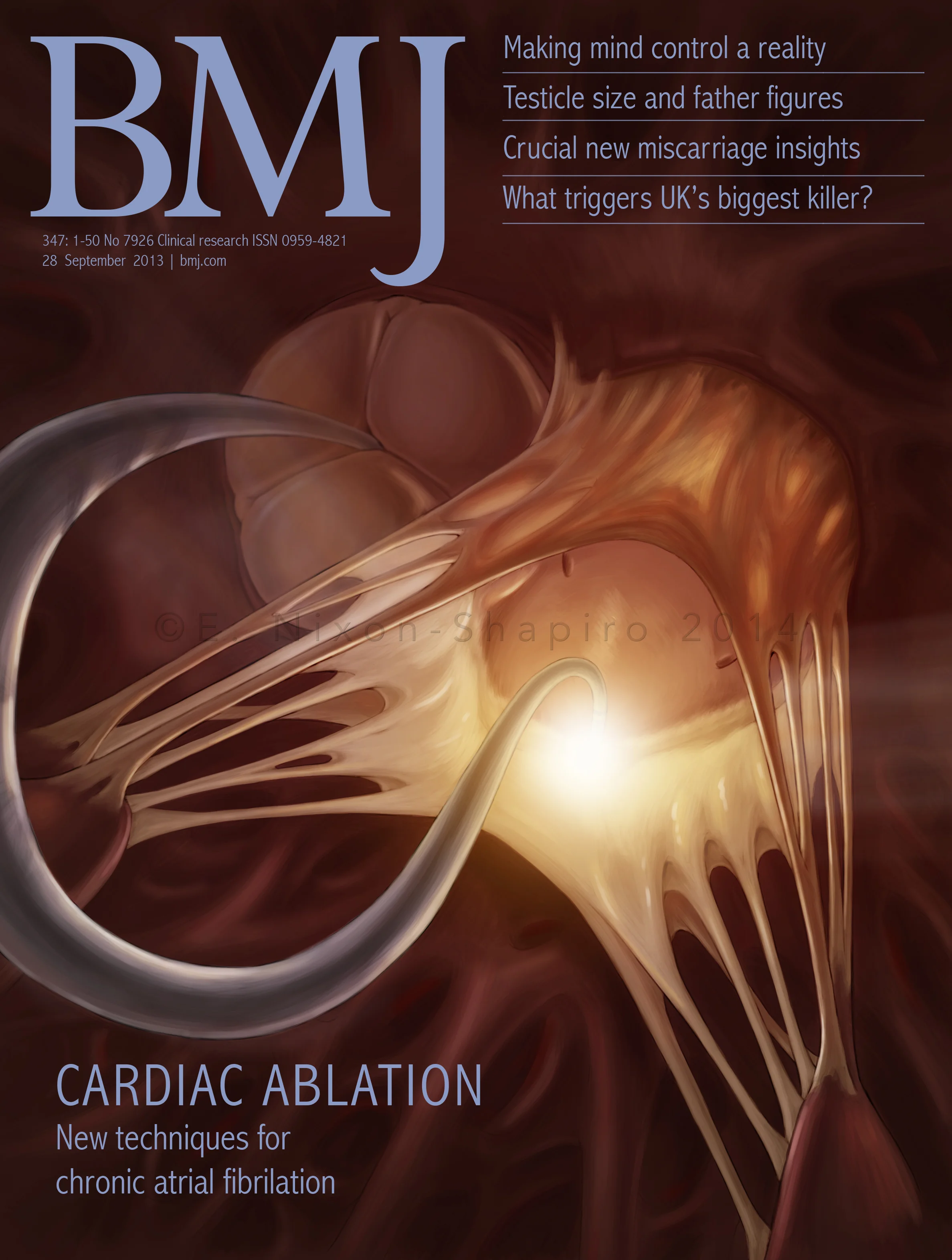 Mock Journal Cover: Cardiac Ablation of the Mitral Valve