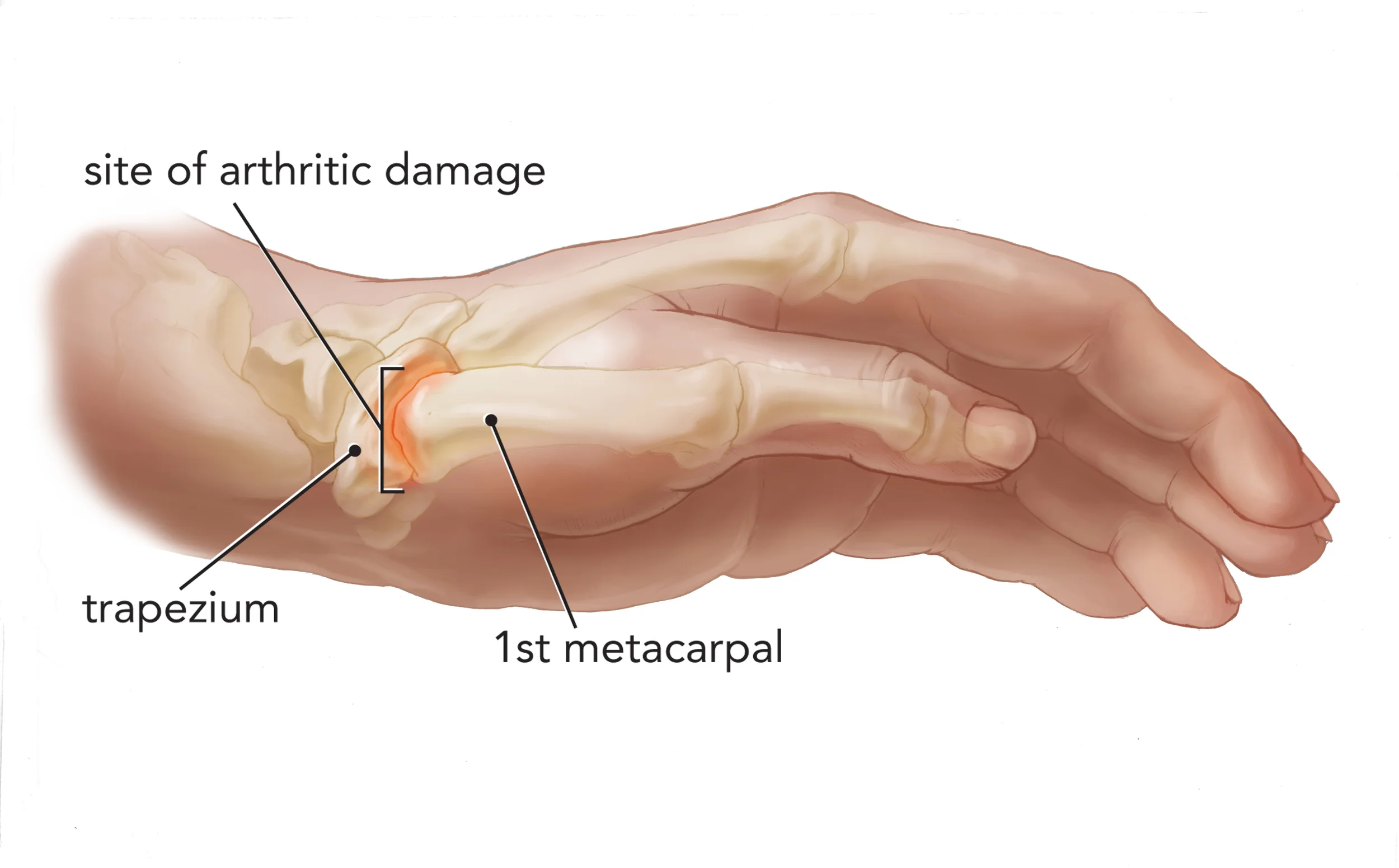 Anchovy Procedure (detail)