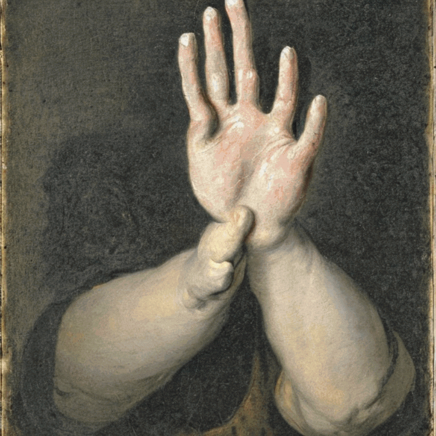 A Hand with Nineteen Fingers in the Style of Goya