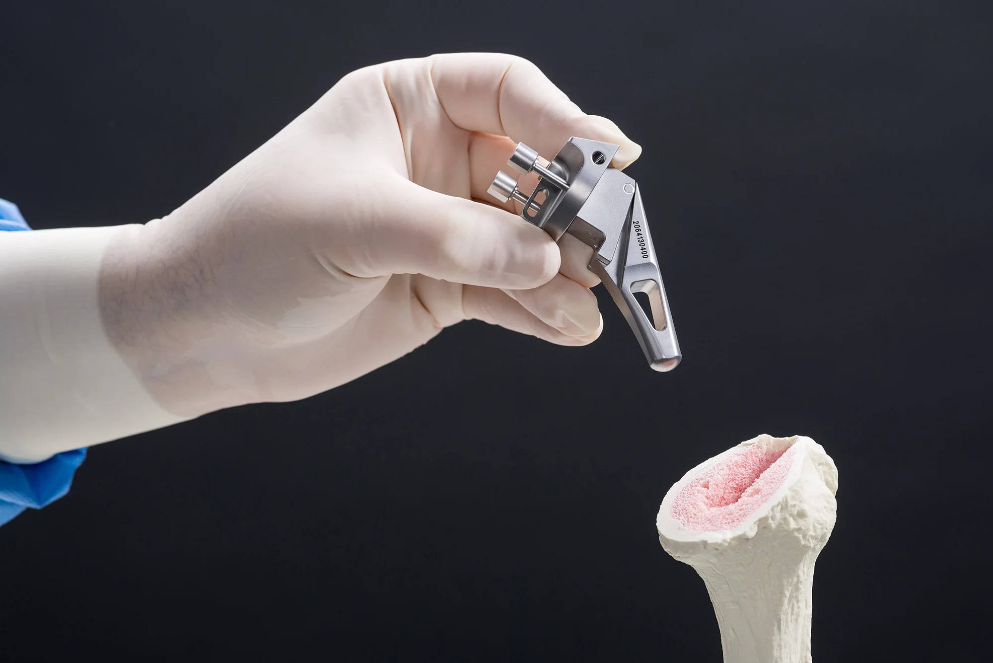 Univers Cuff Arthropathy Head Surgical Technique with Brad Ray, MD