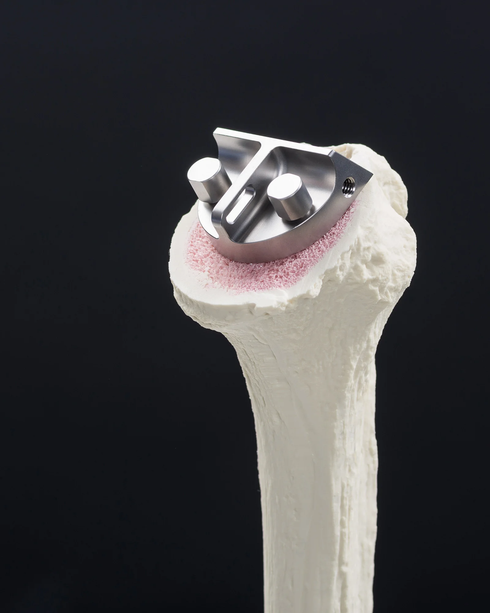 Univers Cuff Arthropathy Head Surgical Technique with Brad Ray, MD