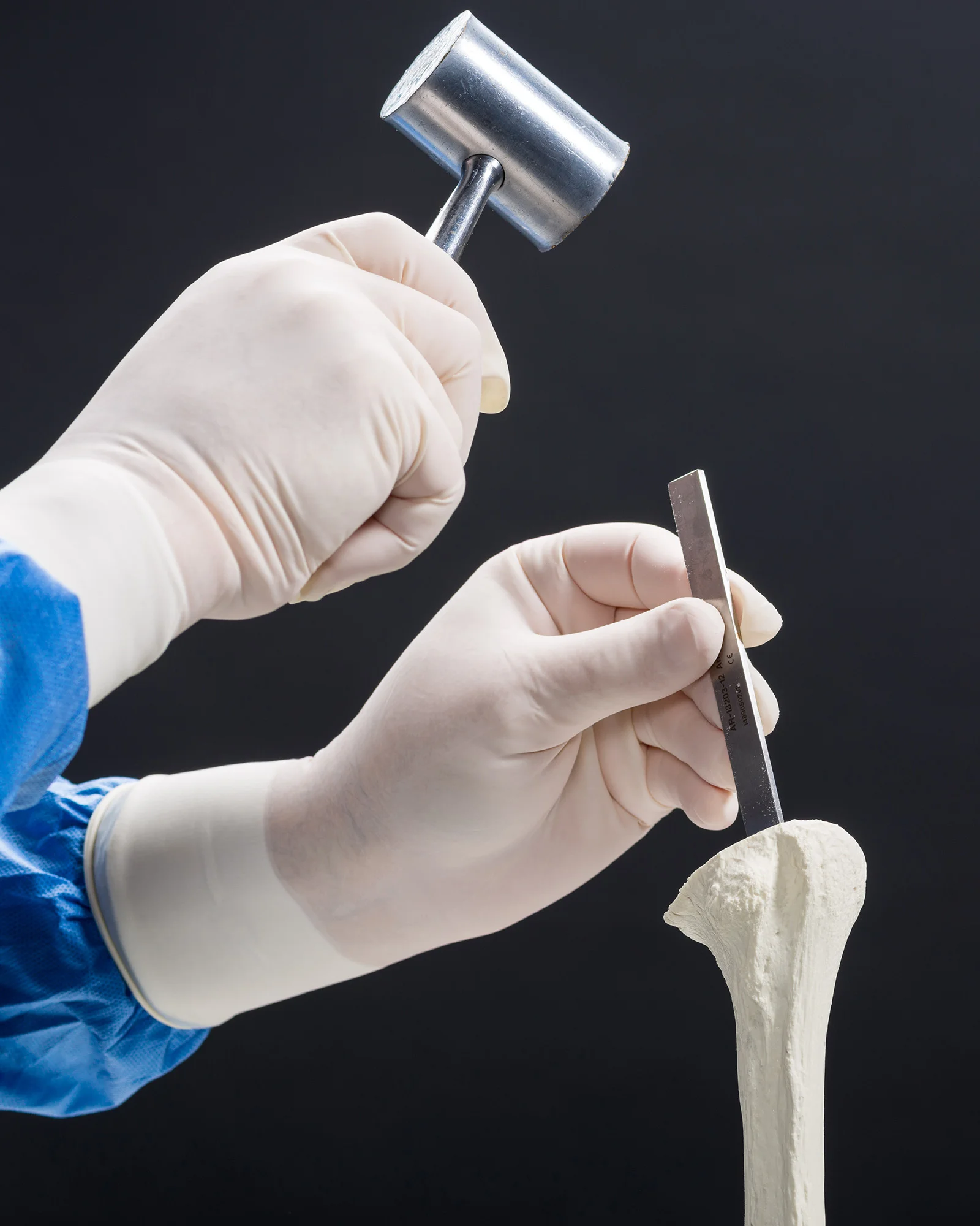 Univers II Head/Stem Removal Technique with Brad Ray, MD