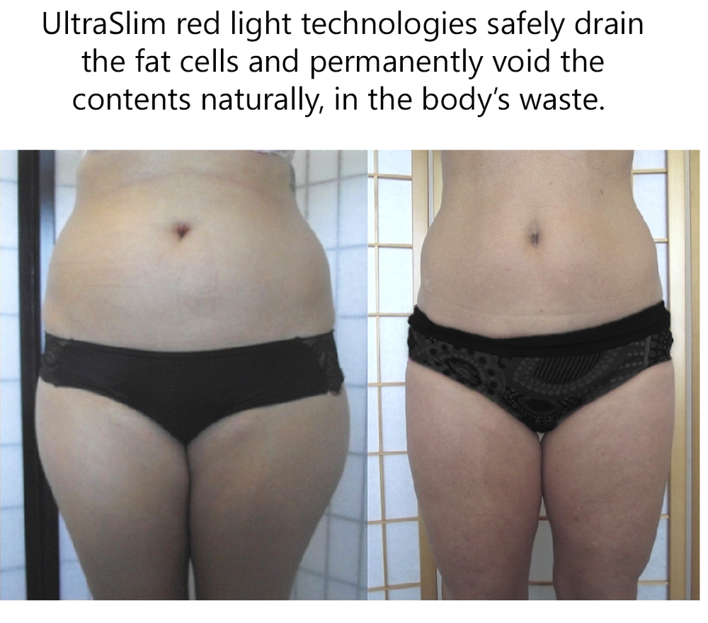 Anti Aging Program Weight Loss And Red Light Therapy Body Contouring Moksha Life Center