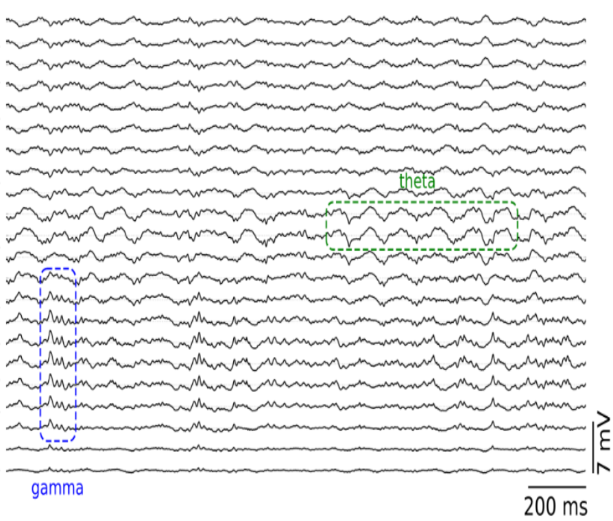 hippocampal signal