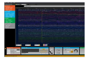 Documentation — Open Ephys