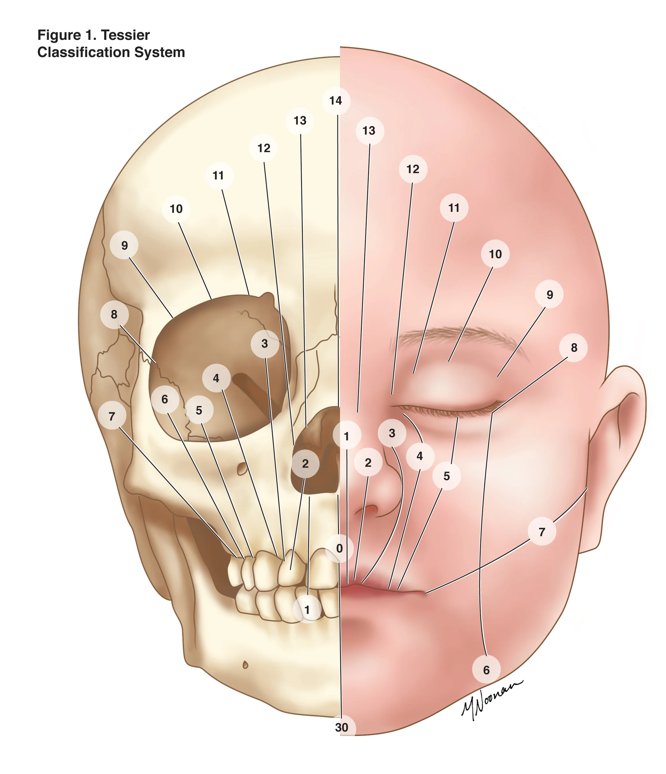 Medical Illustration — Noonan Media