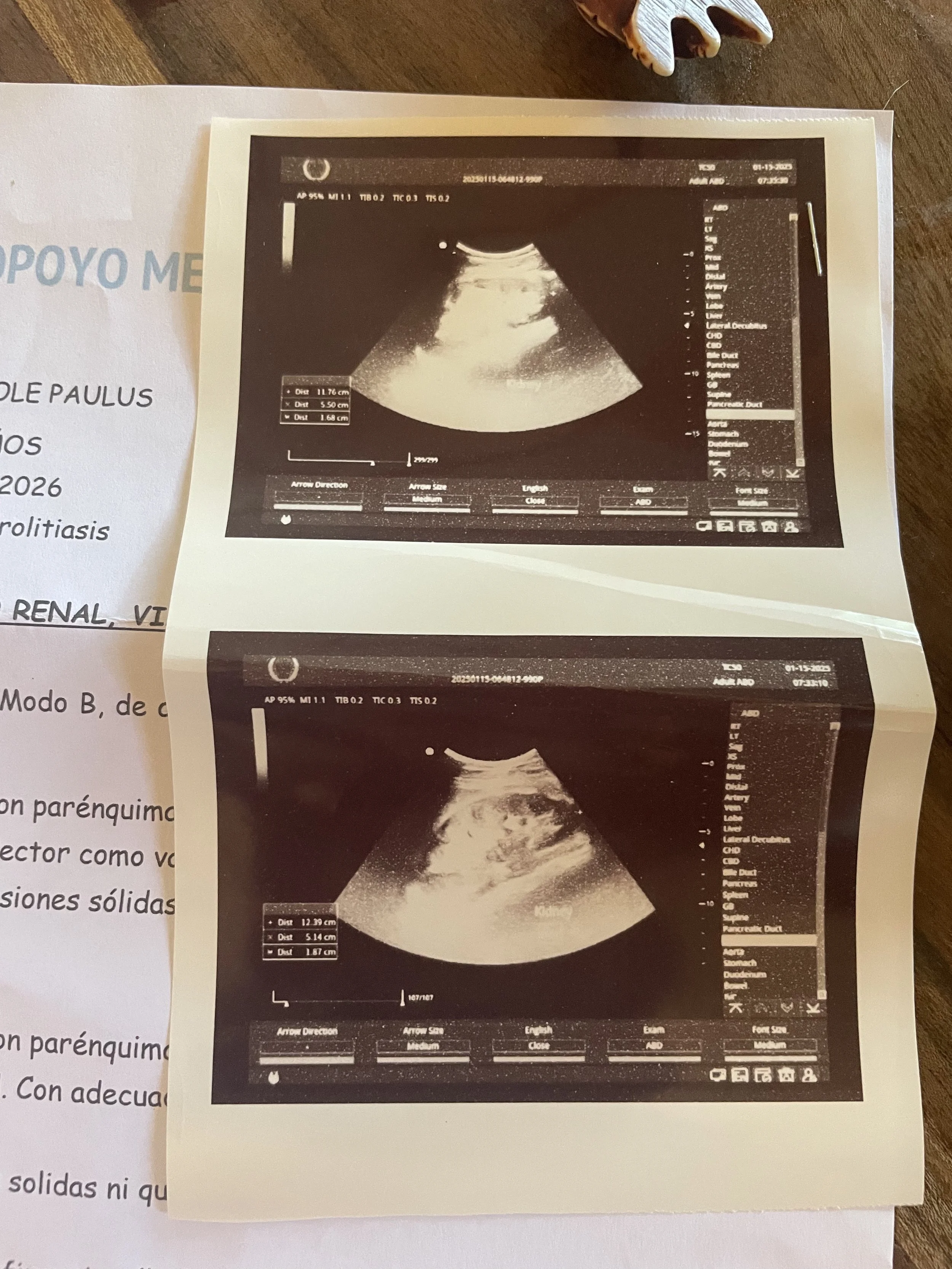 Letting Go of Fear? Nah.