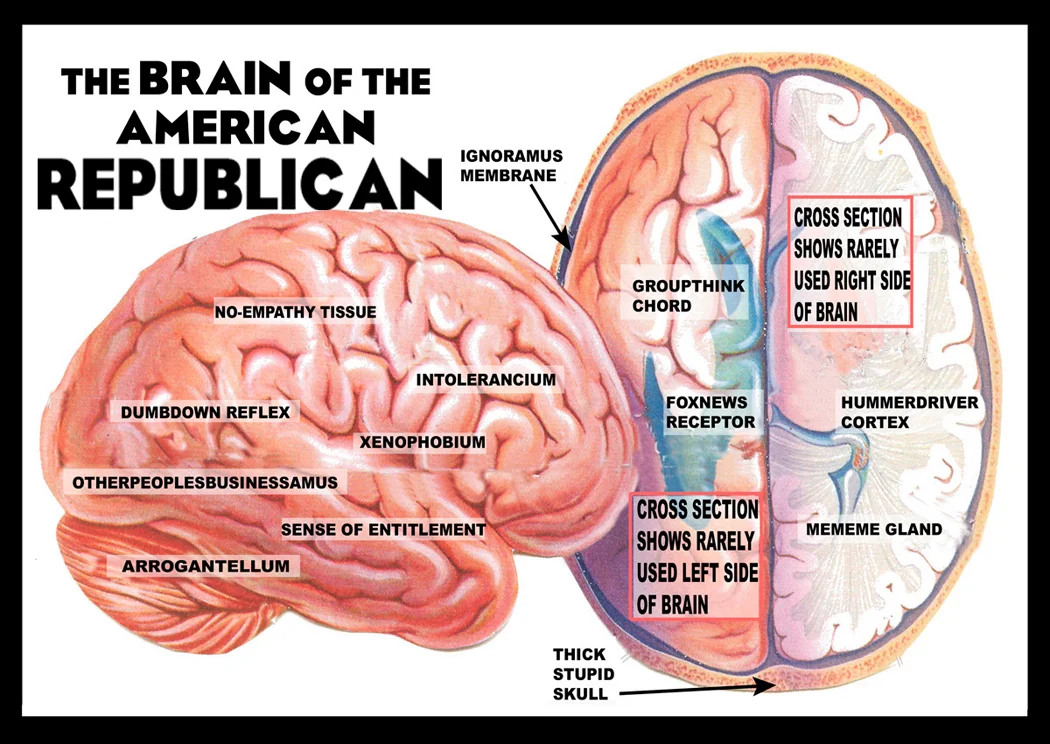 brain_republican.jpg