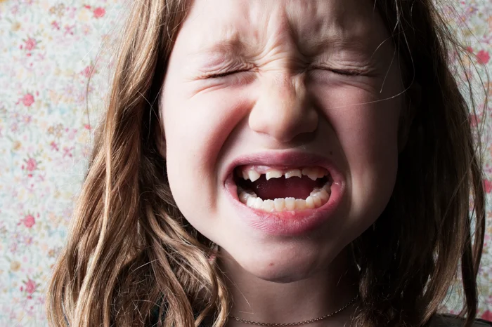 fat lip broken teeth-2.jpg