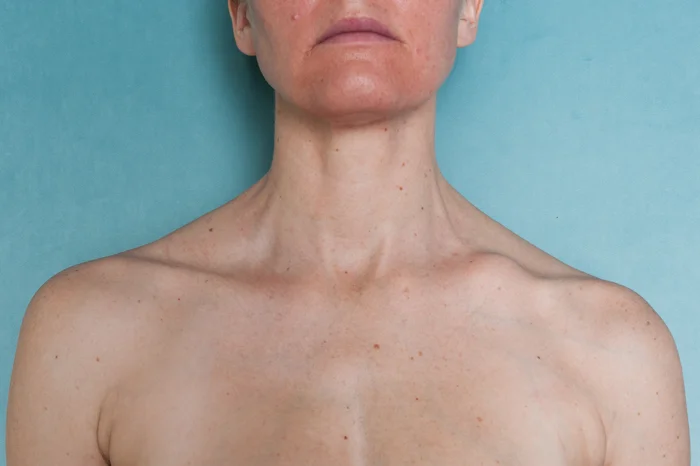 scars that remain.jpg