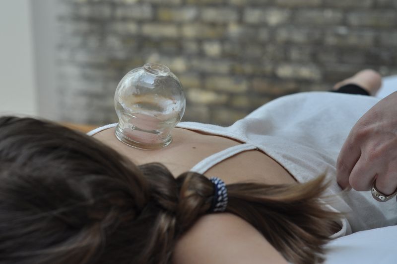 CUPPING