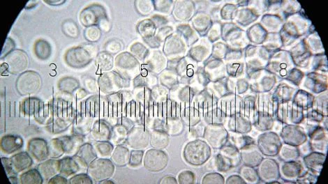 GENETIC LEGACIESA