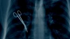 Resentments Are the #1 Offender