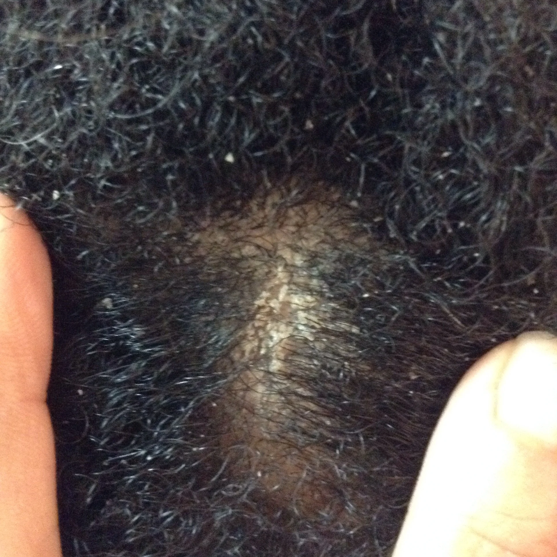 Be sure to give you scalp a thorough wash using the flat surface of your fingernails or the pads of your fingers to remove any leftover shampoo and sebum that may still be there. 