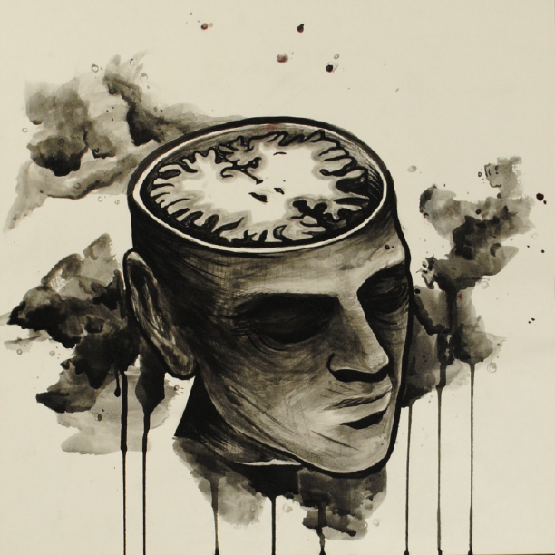 MRI Head 1.png