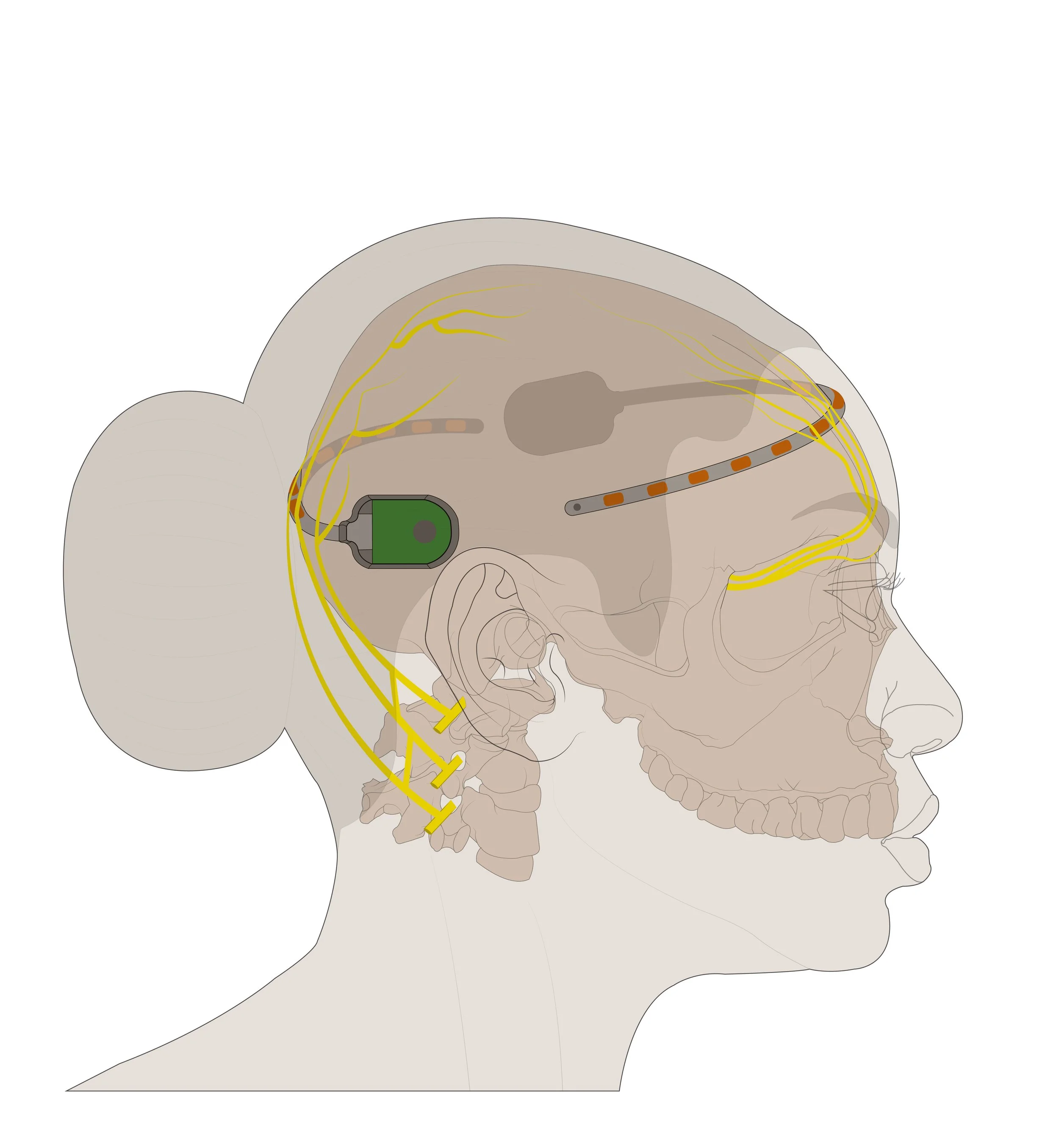 Completed_lateral 2.jpg