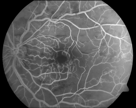 An example of the images of the eye I've been exposed to recently...guess they rubbed off into my compositions!