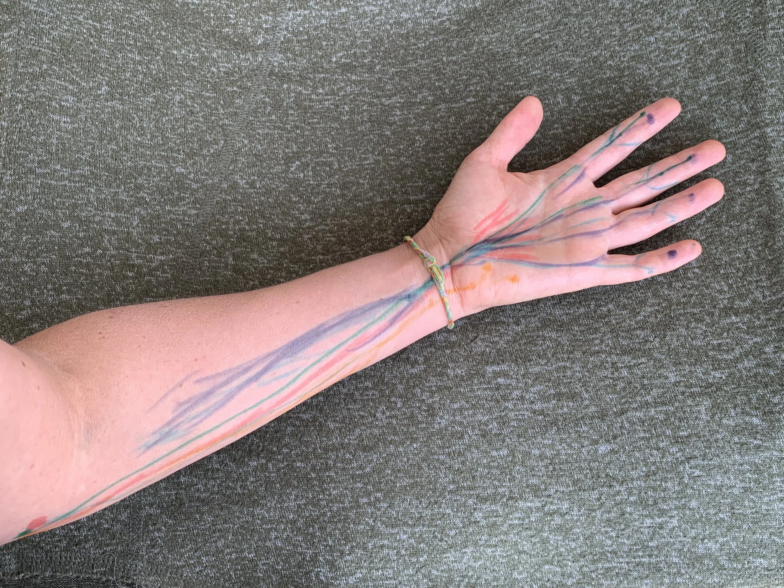 Flexors of the Wrists and Fingers