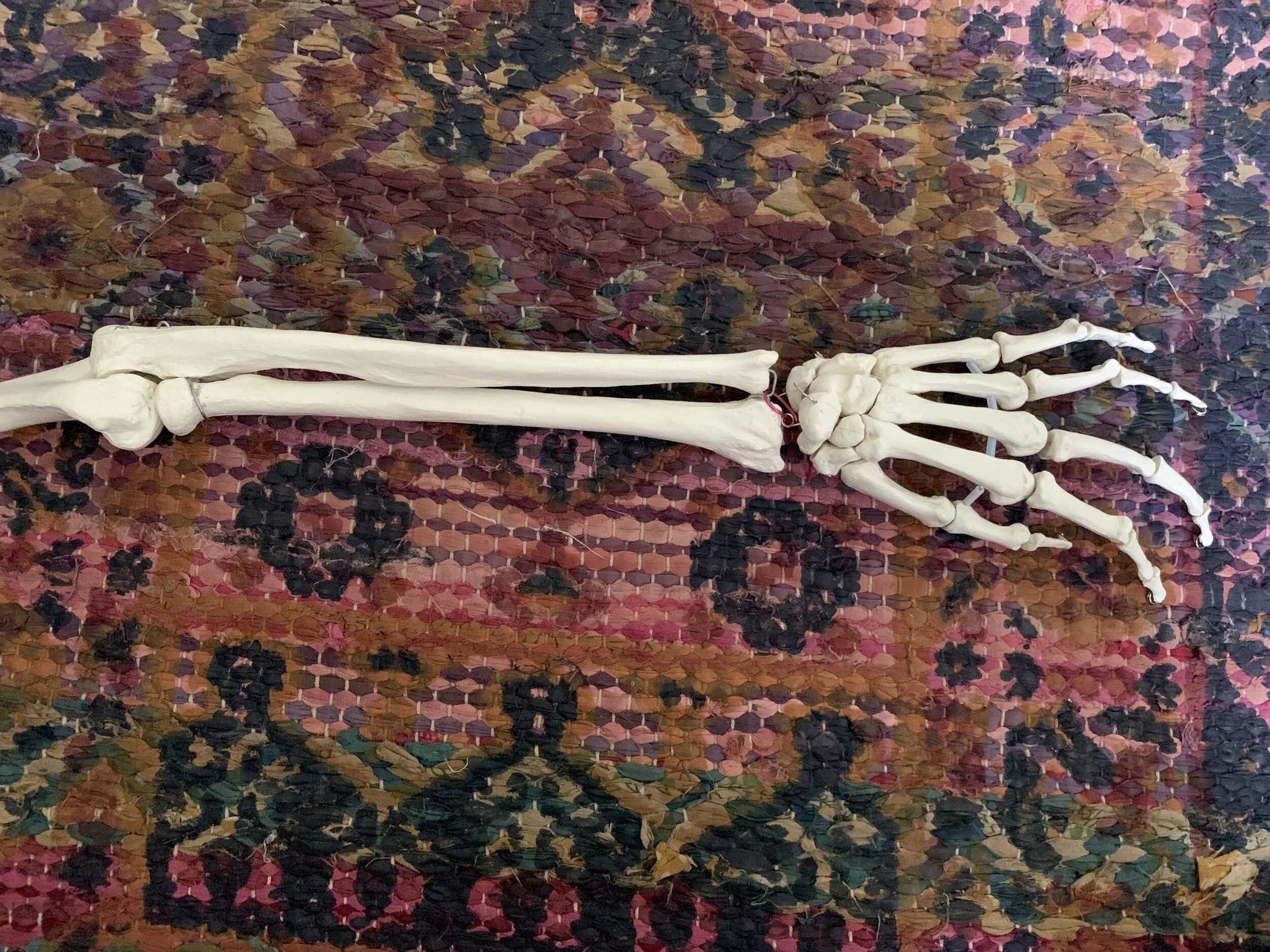 Locating the Extensors of the Wrist and Fingers