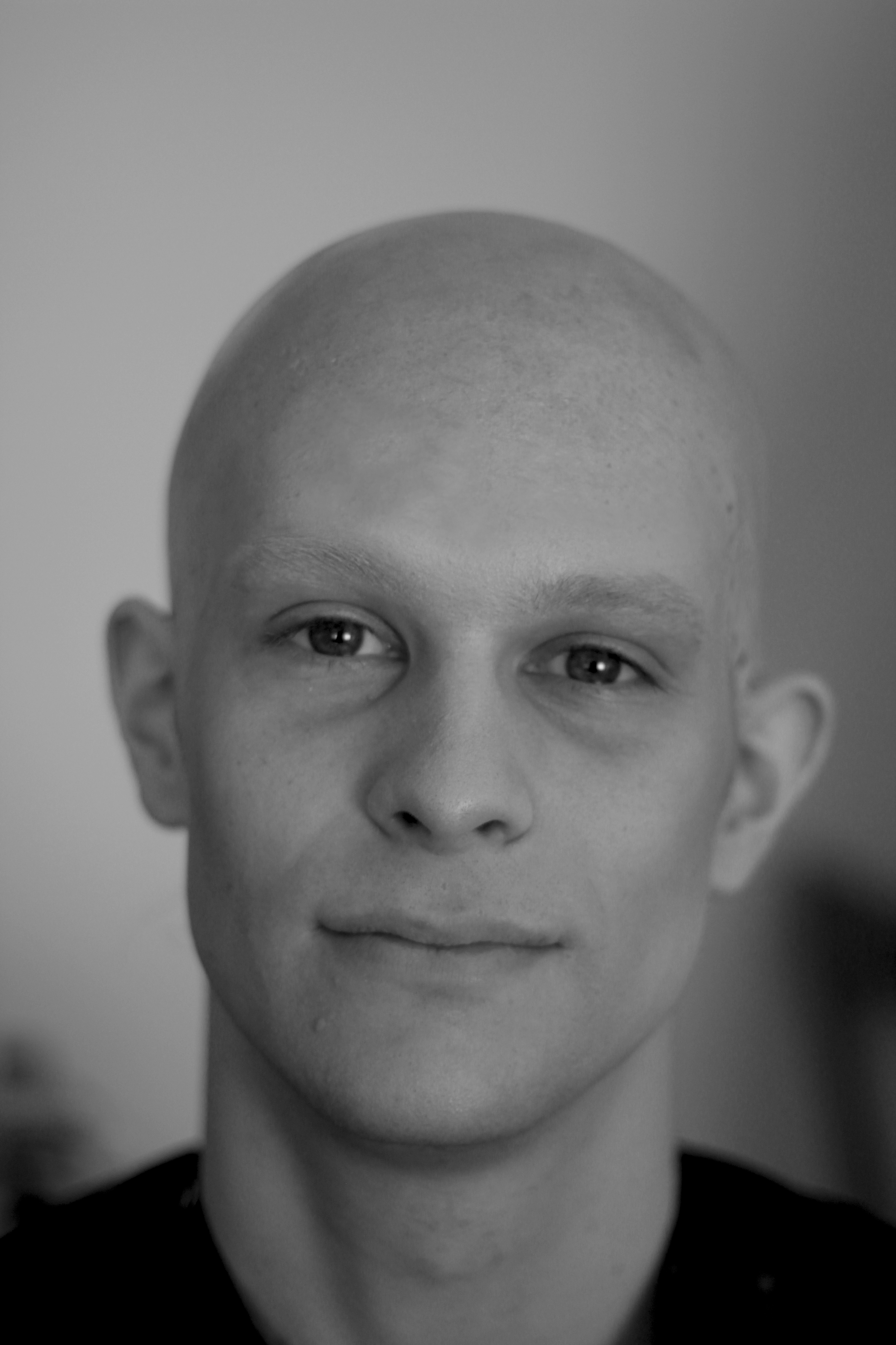 Model: Rob Kendrick || After Bald Cap || Photographer: Barney Mccann