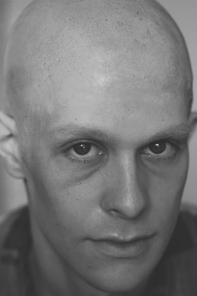 Model: Rob Kendrick || After Bald Cap || Photographer: Barney Mccann