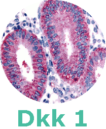 DKK1