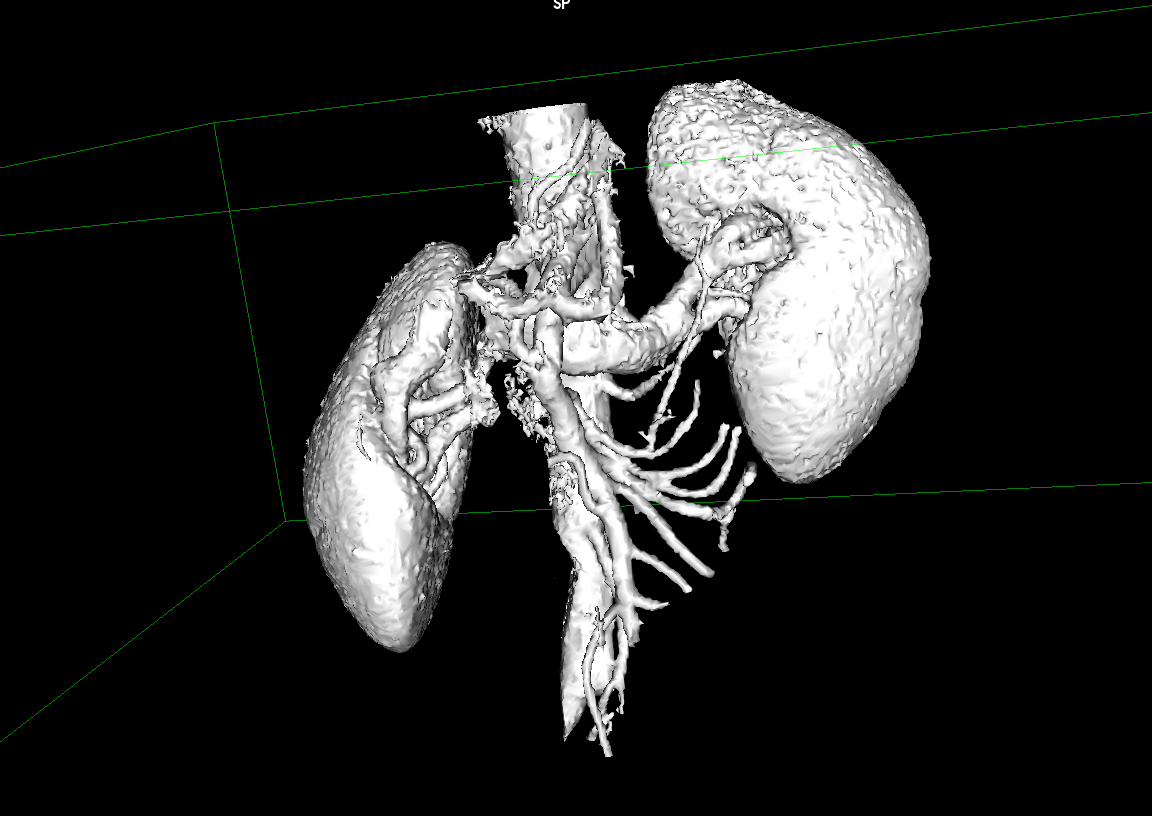 Extracted Mesh