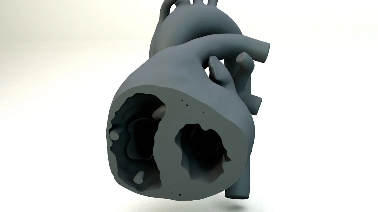Correcting the thickness of the Myocardium