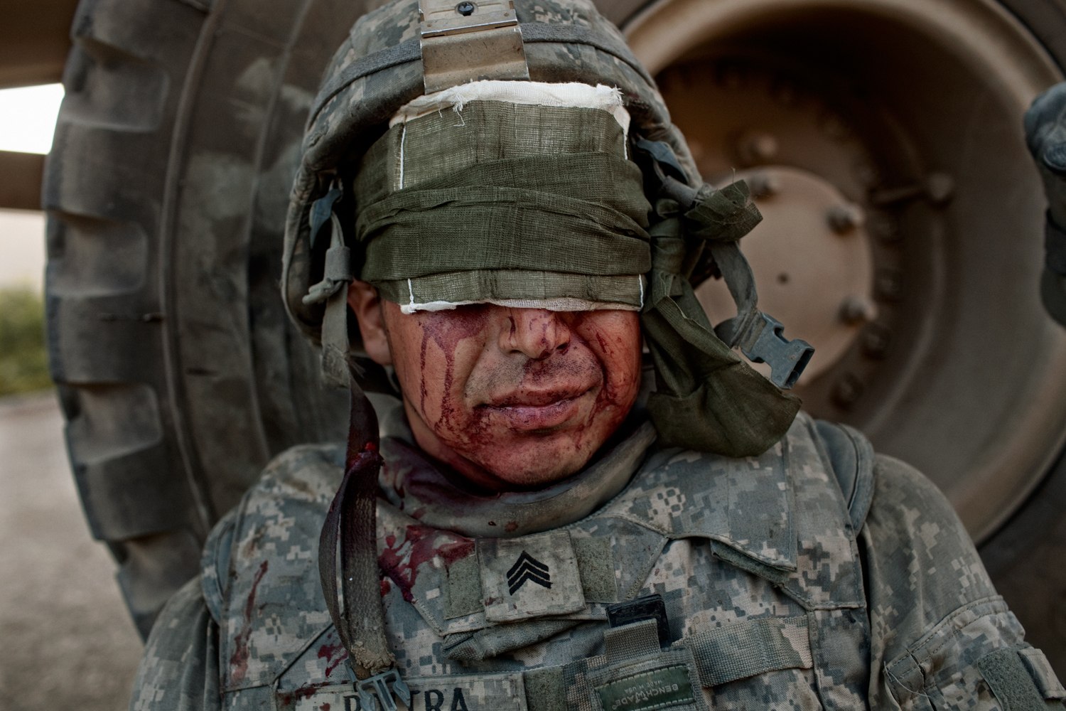  U.S. Army Sergeant Phil Poitra sits with head injuries after an &nbsp;improvised explosive device attack on his vehicle in the Tangi Valley, Wardak Province, Afghanistan.    