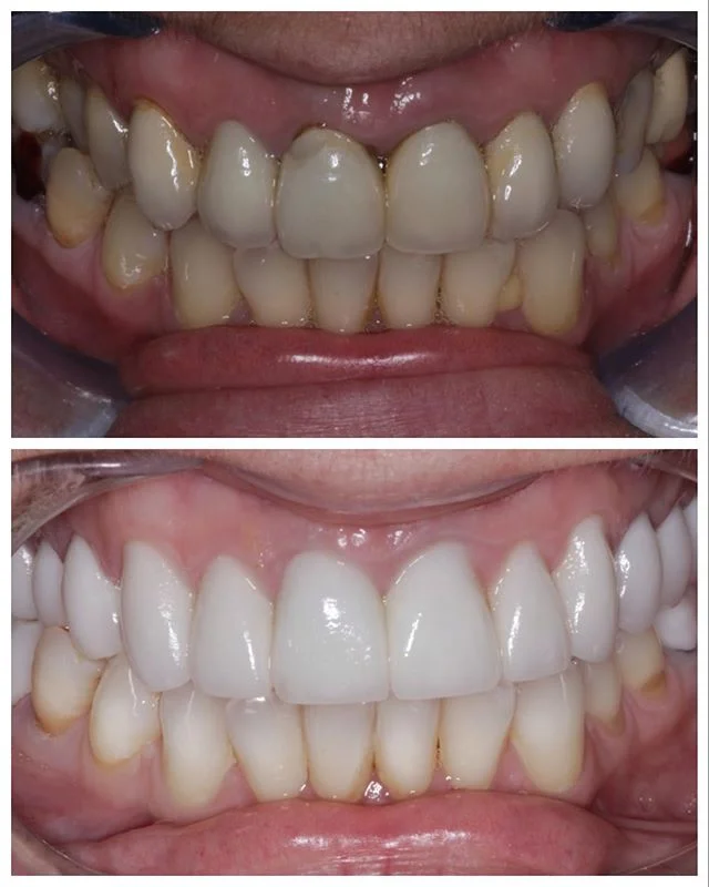 Butterfly Dental Dentists in Manchester, Manchester Dentists, Dental