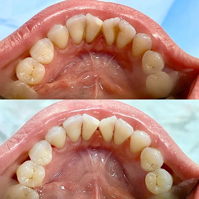 Butterfly Dental Dentists in Manchester, Manchester Dentists, Dental