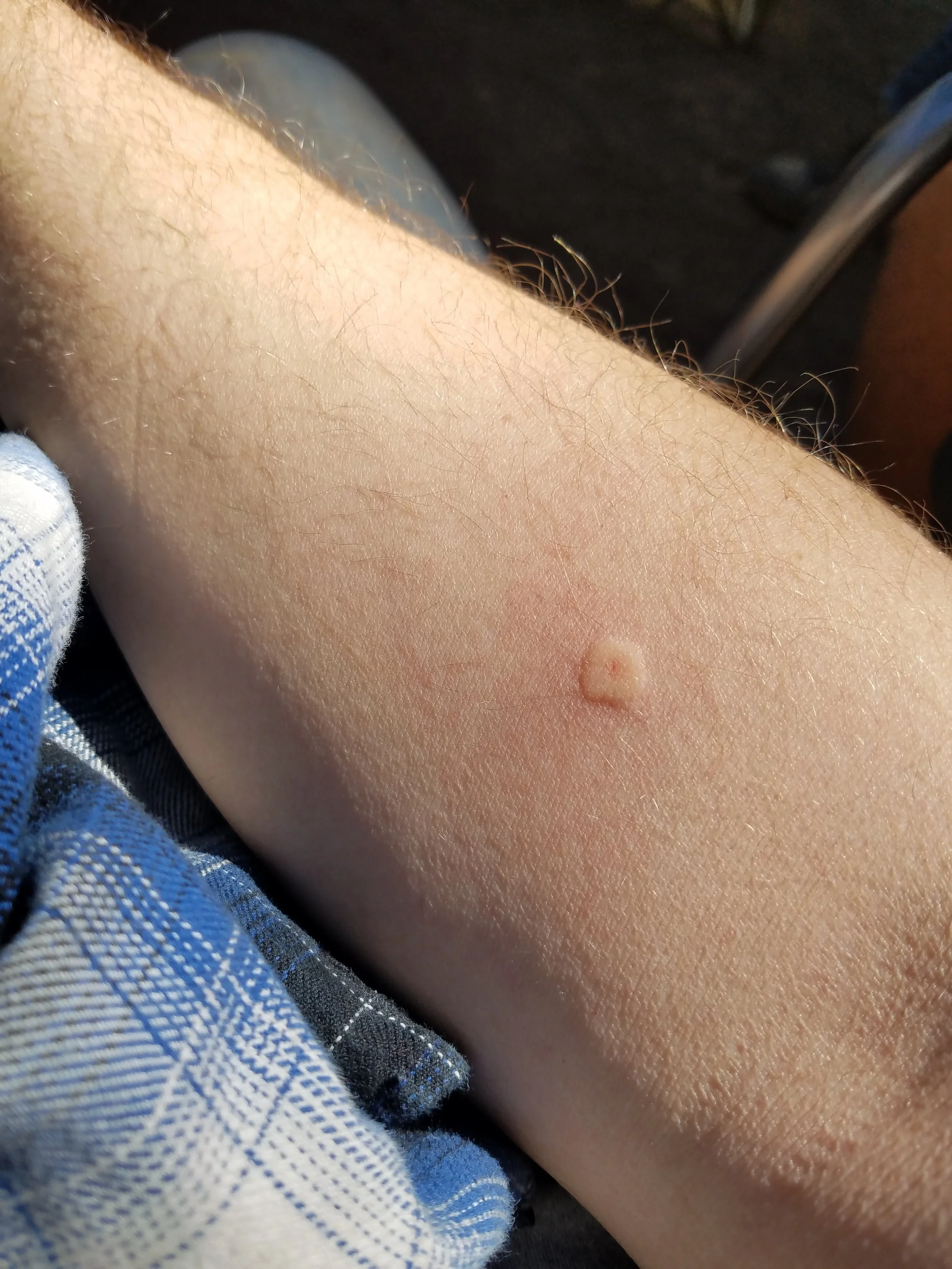 My forearm (mid-swell)