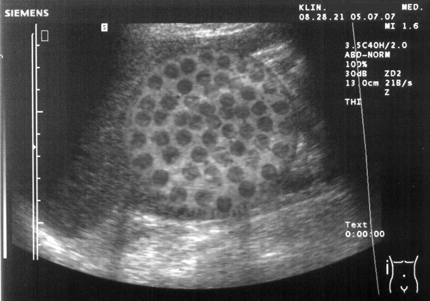 This is the first ultrasound we so thoughtfully sent to our families. 