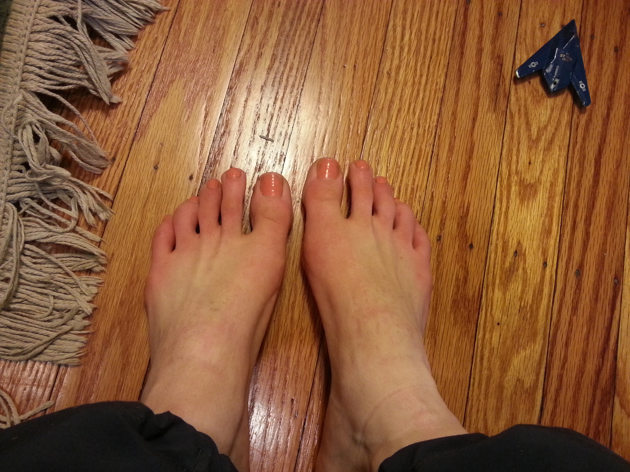 My feet, post-walk, with barely-red toes.