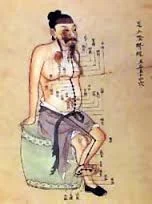 vintage acupuncture 2.jpg