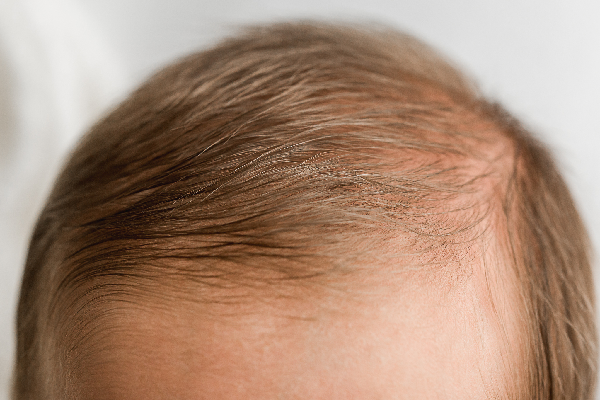 Newborn Baby Hair Image Central Ohio