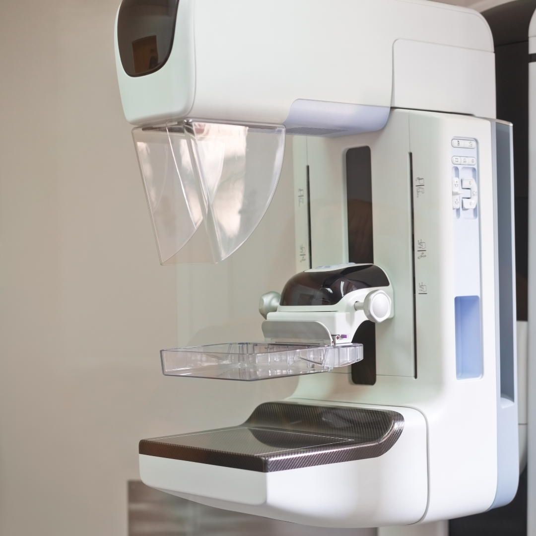 The Mammogram PSA