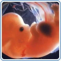 7-weeks-pregnant-fetus.jpg