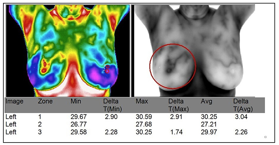 Verhuizer bus Uitgestorven Body and Breast Thermal Imaging — Recharge Your Life