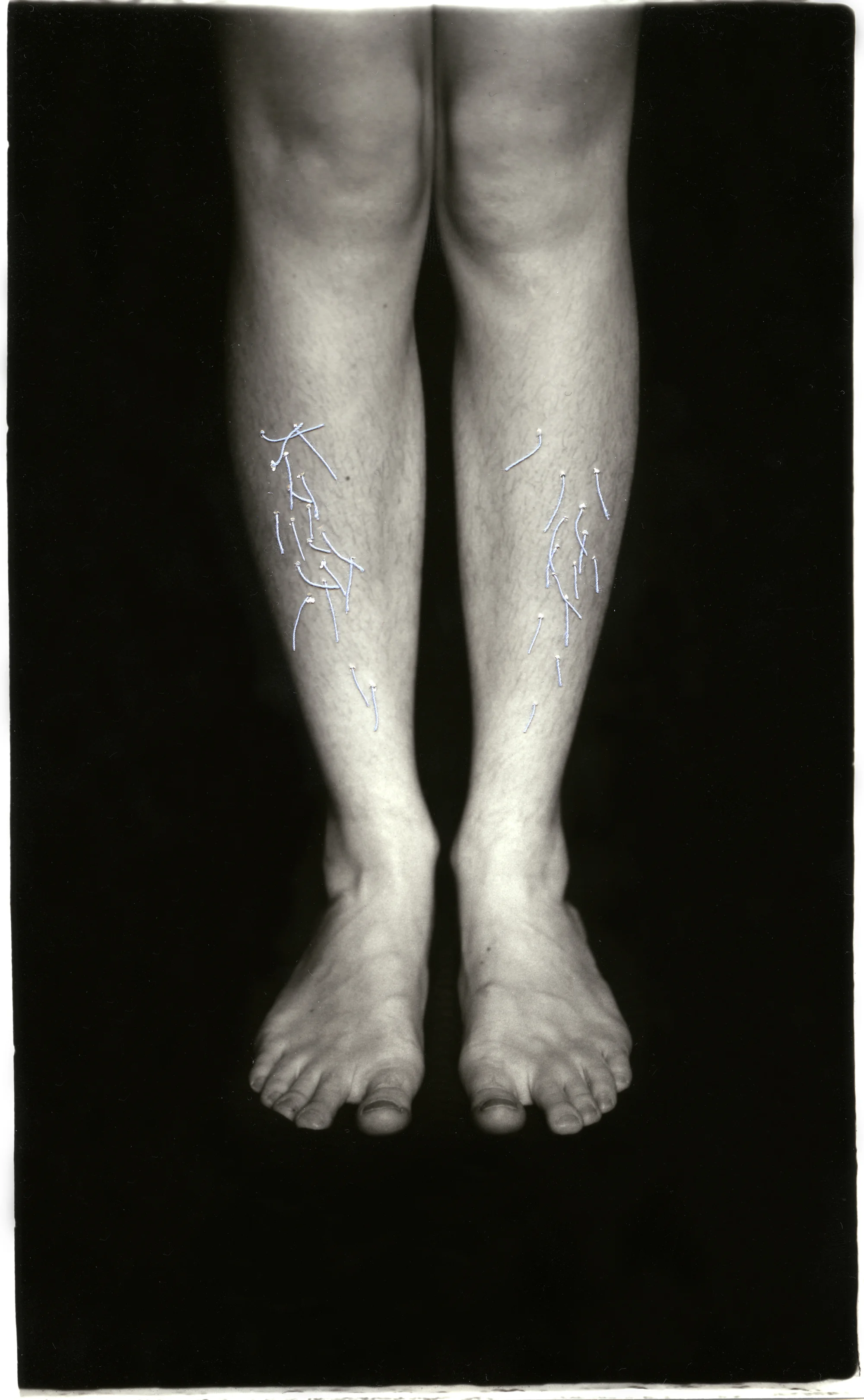 Ingrown Silver Gelatin Print, Thread, 2014