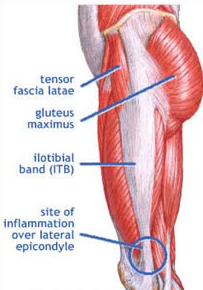 Get To Know Your Muscles - TFL (Tensor Fasciae Latae) — Kinfolk ...