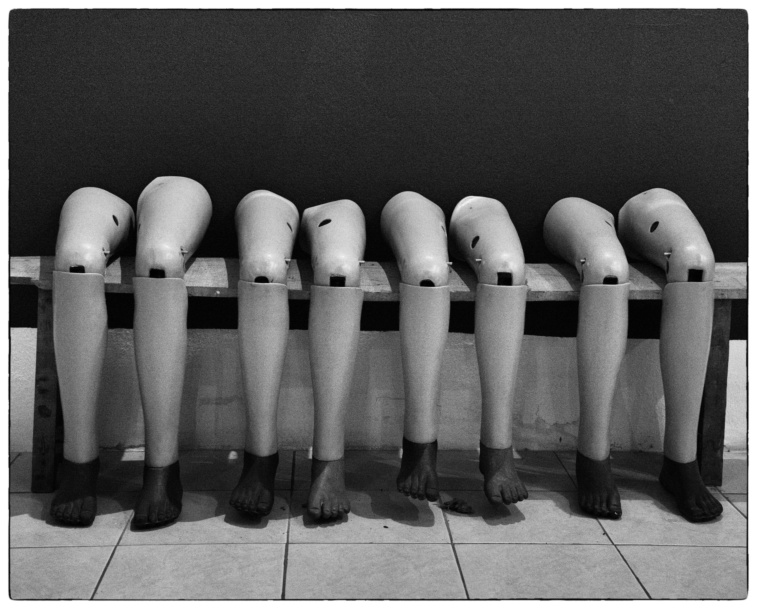 Prosthetic legs, Vientiane, Laos.jpg