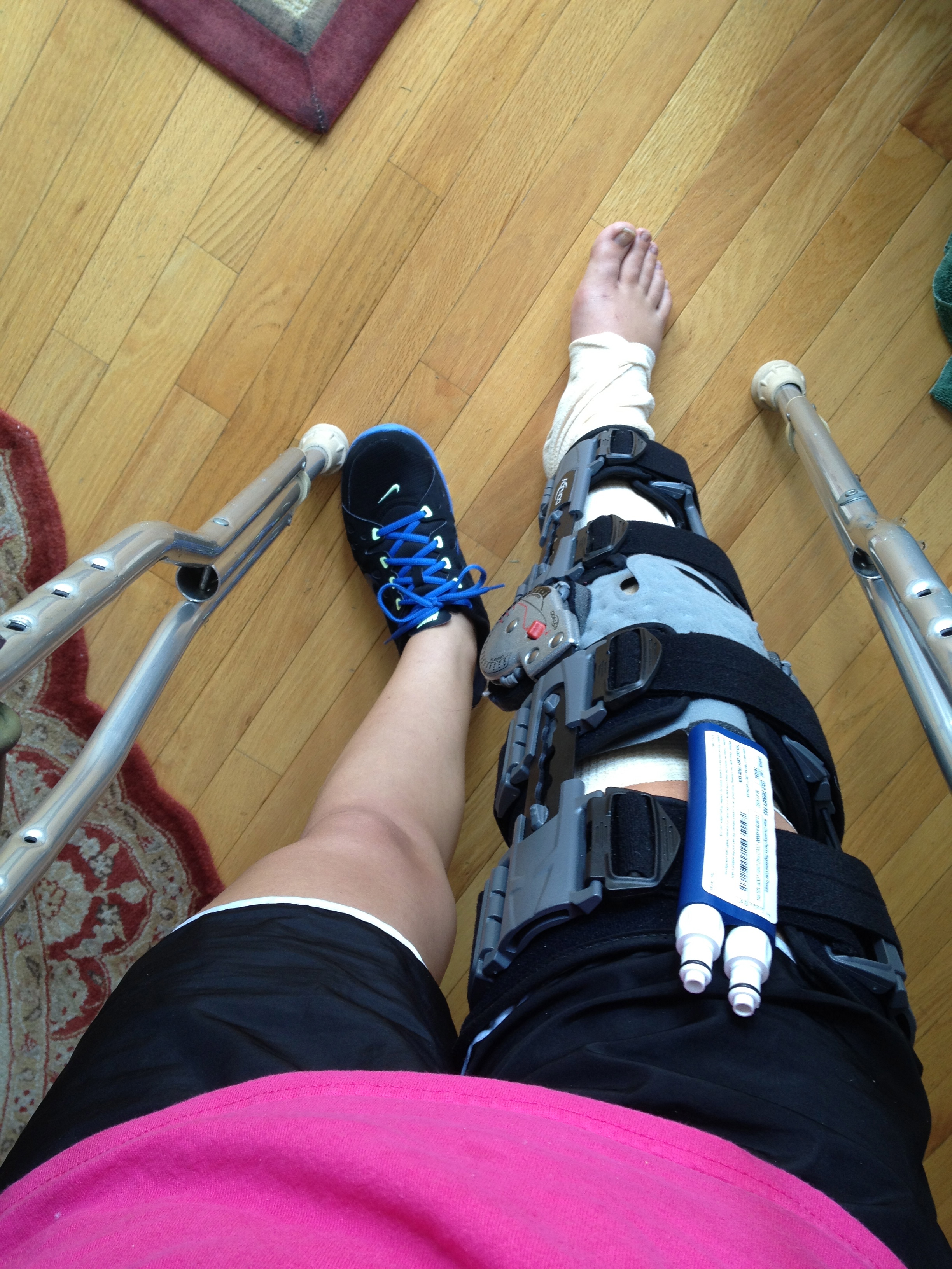 It took me weeks before this whole upright, standing, crutching around thing happened.