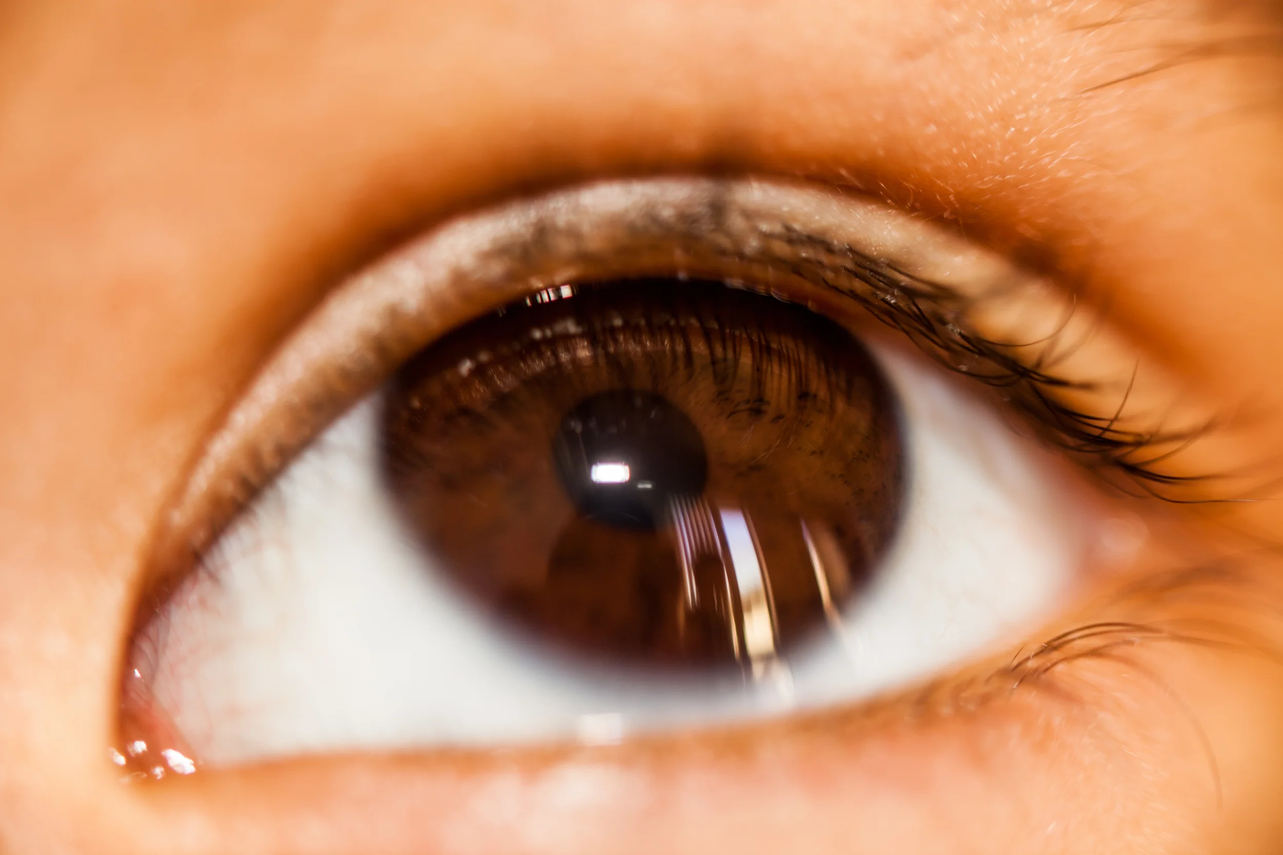 Christopher's eye.jpg