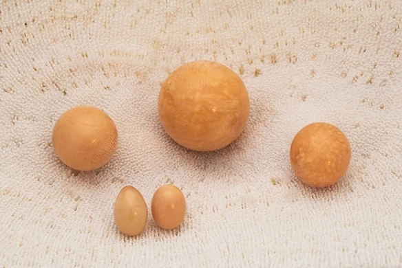 Melo Pearls from Burma