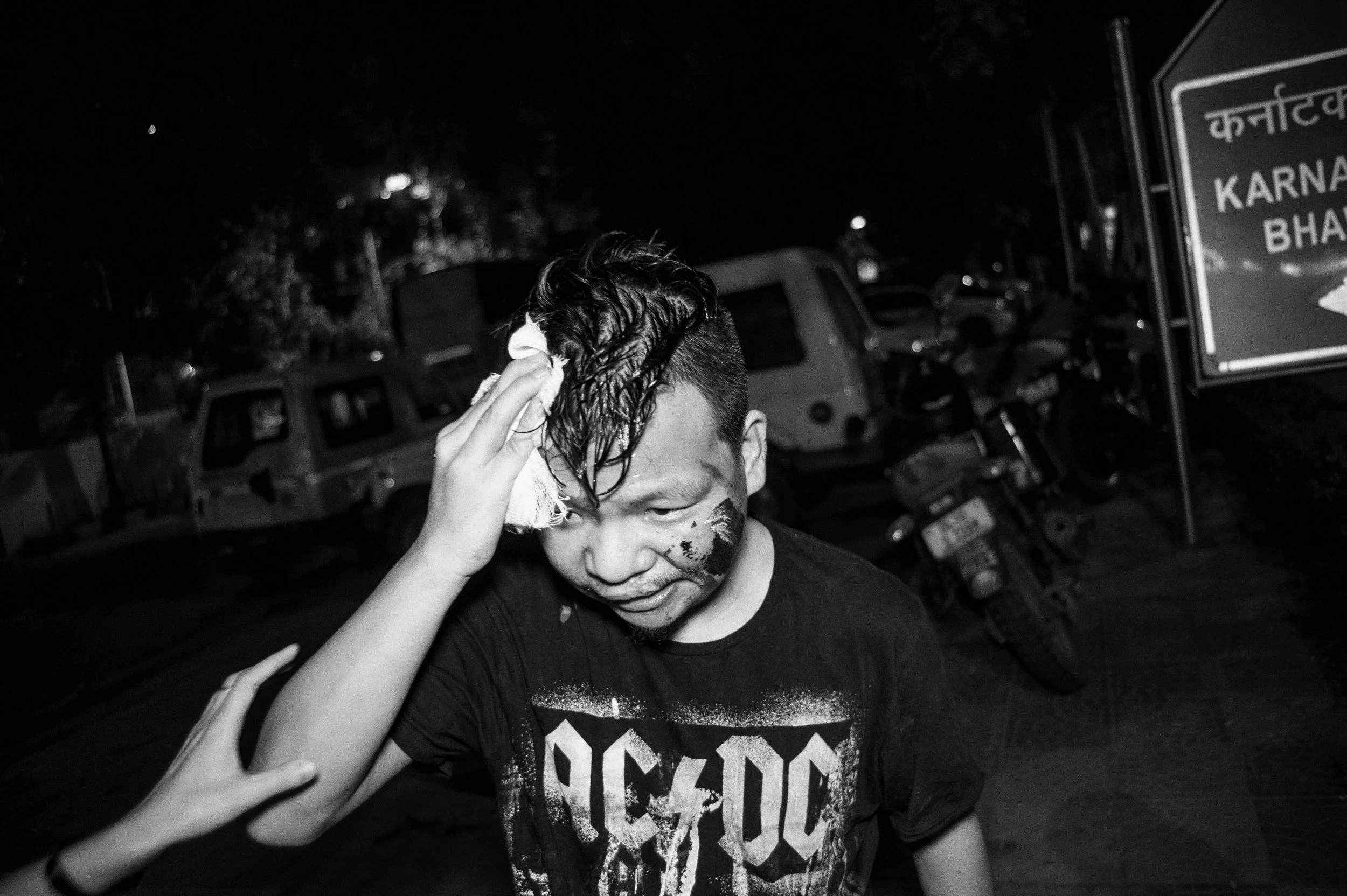  June,&nbsp;2016: An Injured protester after Police charged them and used indiscriminate force. Several were injured and many detained overnight at the Chankyapuri Police station.&nbsp;The protesters from the hills of Manipur, demanded to speak with 